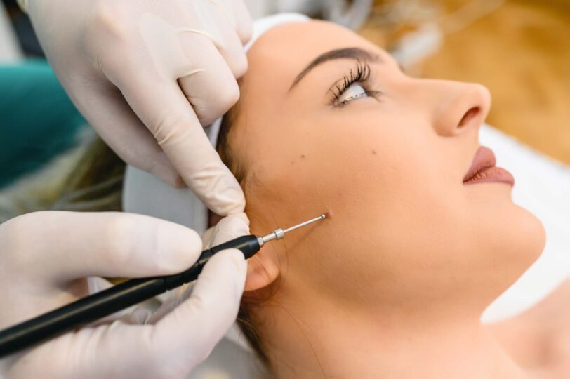 Mole Removal Cost and Treatment Guide